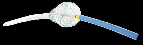 Taewoong esophageal stent delivery system with stent loaded at the catheter tip