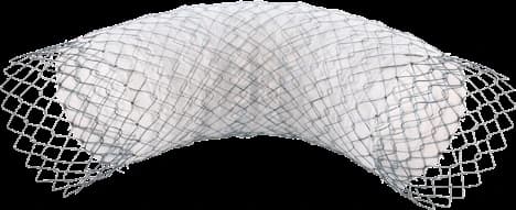 Taewoong Niti-S COMVI enteral colonic stent, triple-layered covered mesh arched