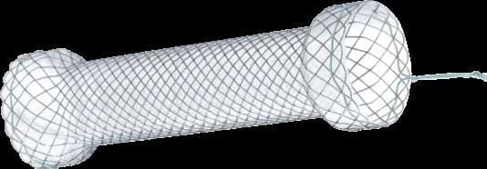 Taewoong Niti-S S esophageal stent, fully covered braided mesh with flared ends