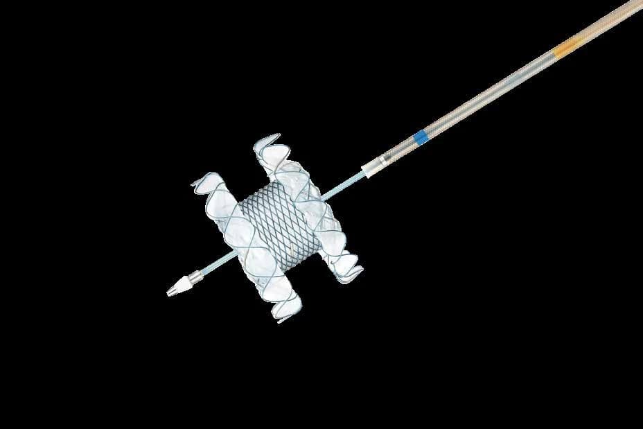 Taewoong Niti-S HOT SPAXUS electrocautery-enhanced lumen-apposing stent on delivery catheter