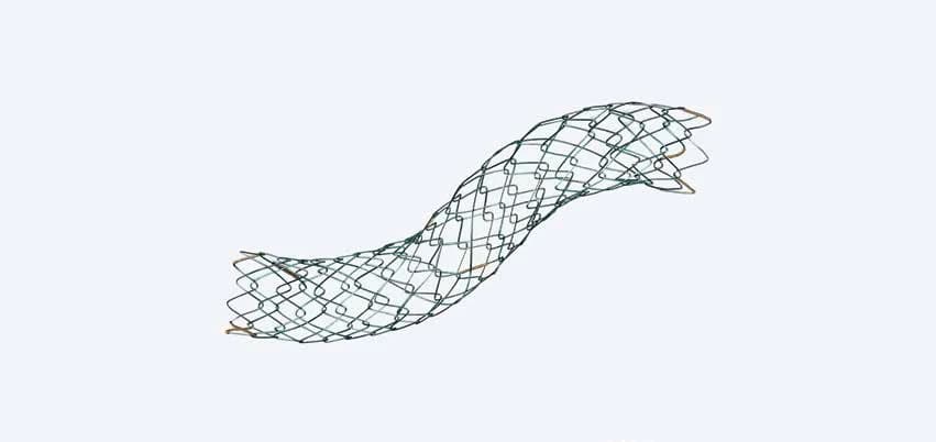Taewoong Niti-S LCD biliary stent flexed in an S-curve