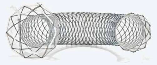 Taewoong Niti-S lumen-apposing metal stent (LAMS)